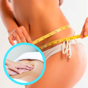 Lipocavitación + Drenaje Linfático