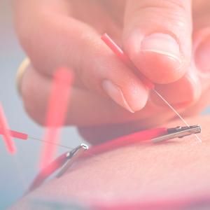 Electropolipólisis + Radiofrecuencia y Drenaje Linfático Manual