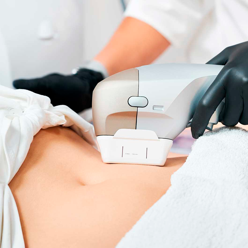 Hifu Corporal 1 Zona Amplia