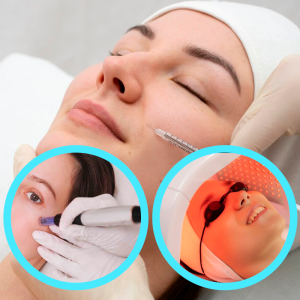 Mesoterapia con Dermapen + Principio Activo + Fototerapia Led Calcium
