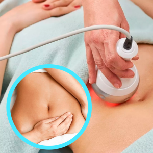 Radiofrecuencia Corporal+ Drenaje Linfático Manual